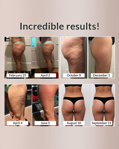 Curvvvy™ Seamless Contour Scrunch Butt Yoga Leggings